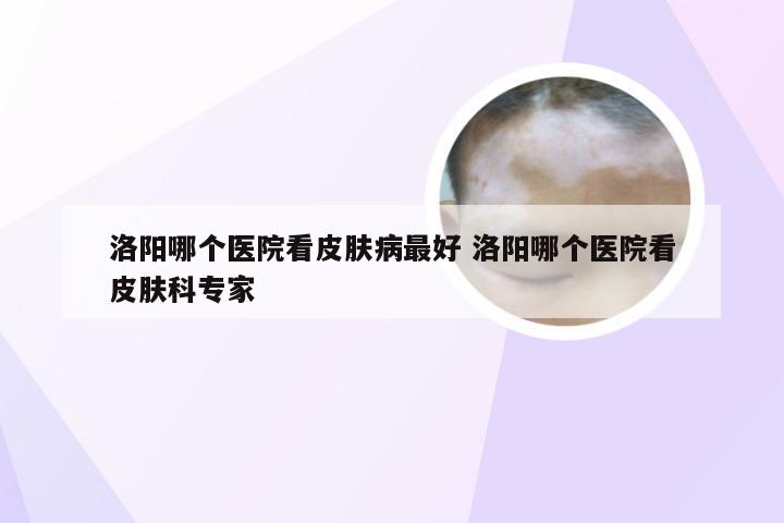 洛阳哪个医院看皮肤病最好 洛阳哪个医院看皮肤科专家