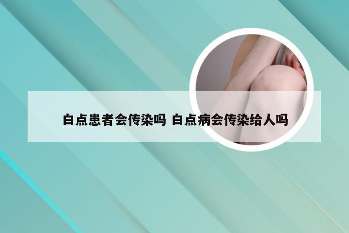 白点患者会传染吗 白点病会传染给人吗