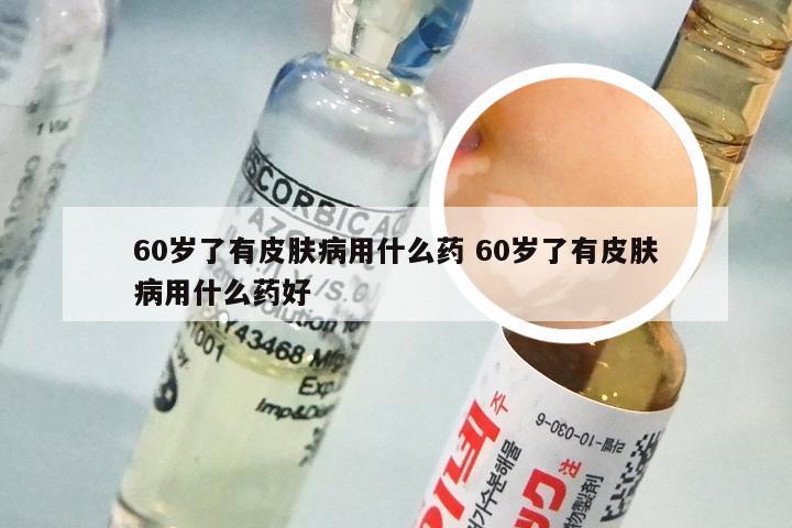 60岁了有皮肤病用什么药 60岁了有皮肤病用什么药好