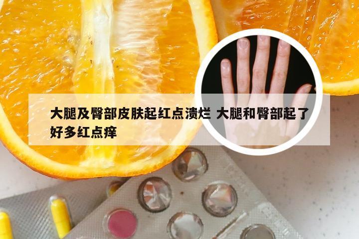 大腿及臀部皮肤起红点溃烂 大腿和臀部起了好多红点痒