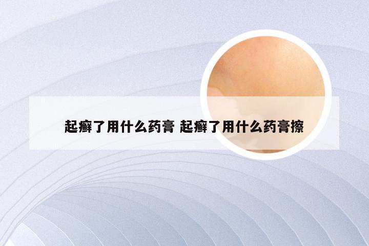 起癣了用什么药膏 起癣了用什么药膏擦