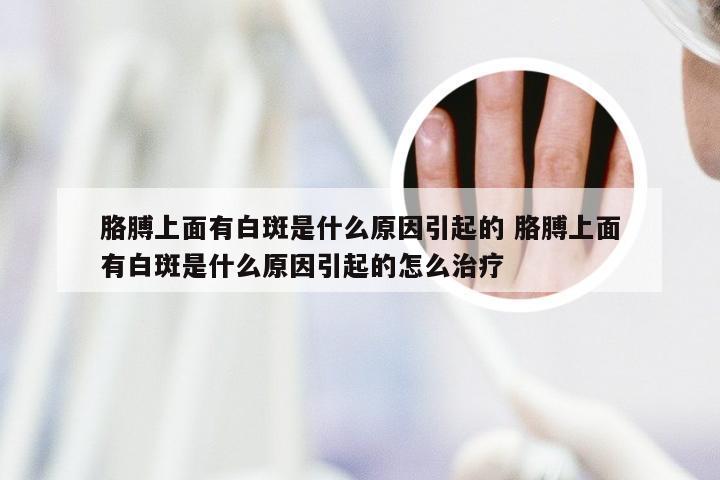 胳膊上面有白斑是什么原因引起的 胳膊上面有白斑是什么原因引起的怎么治疗