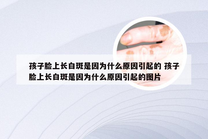 孩子脸上长白斑是因为什么原因引起的 孩子脸上长白斑是因为什么原因引起的图片