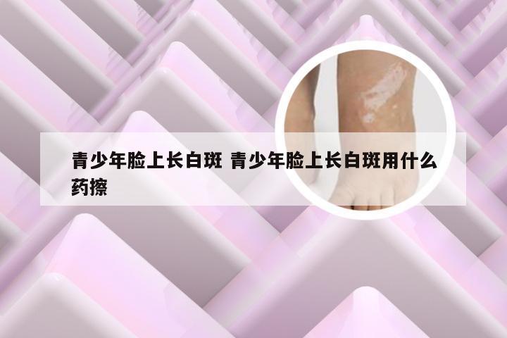 青少年脸上长白斑 青少年脸上长白斑用什么药擦