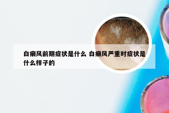 白癞风前期症状是什么 白癞风严重时症状是什么样子的