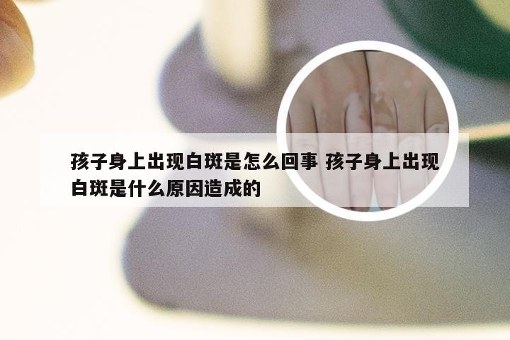 孩子身上出现白斑是怎么回事 孩子身上出现白斑是什么原因造成的