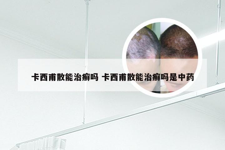 卡西甫散能治癣吗 卡西甫散能治癣吗是中药