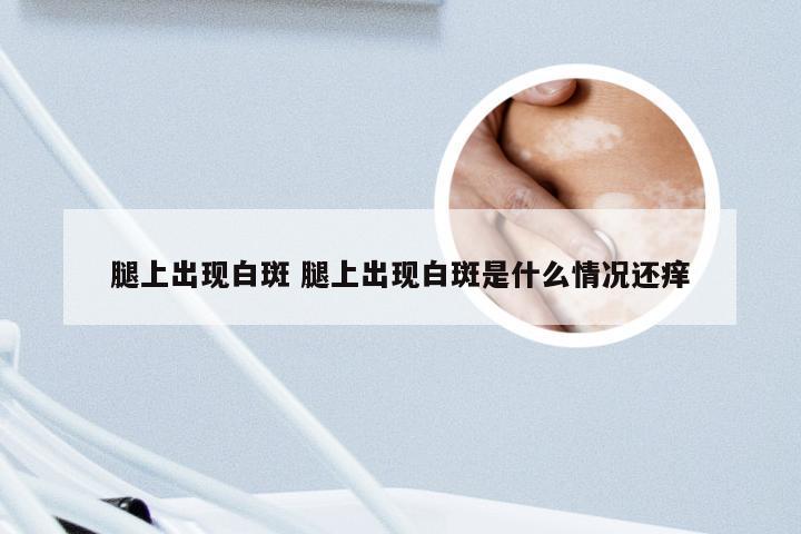 腿上出现白斑 腿上出现白斑是什么情况还痒