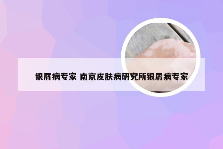 银屑病专家 南京皮肤病研究所银屑病专家