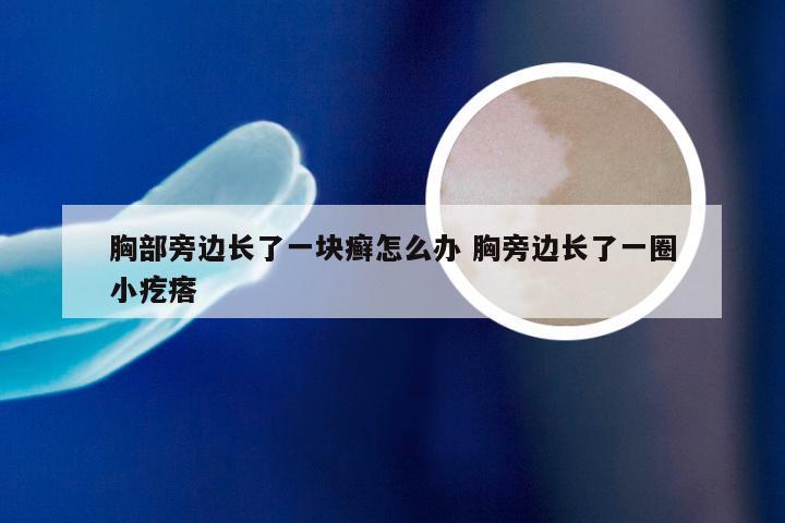 胸部旁边长了一块癣怎么办 胸旁边长了一圈小疙瘩