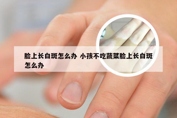 脸上长白斑怎么办 小孩不吃蔬菜脸上长白斑怎么办