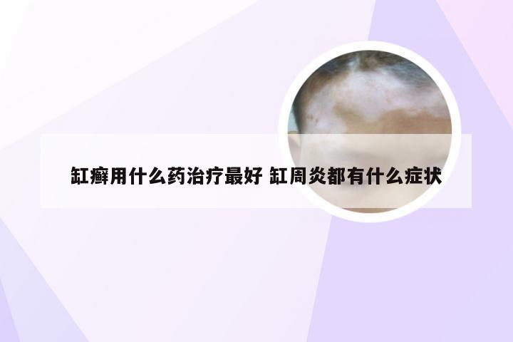 缸癣用什么药治疗最好 缸周炎都有什么症状