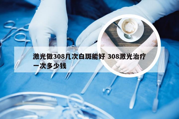 激光做308几次白斑能好 308激光治疗一次多少钱