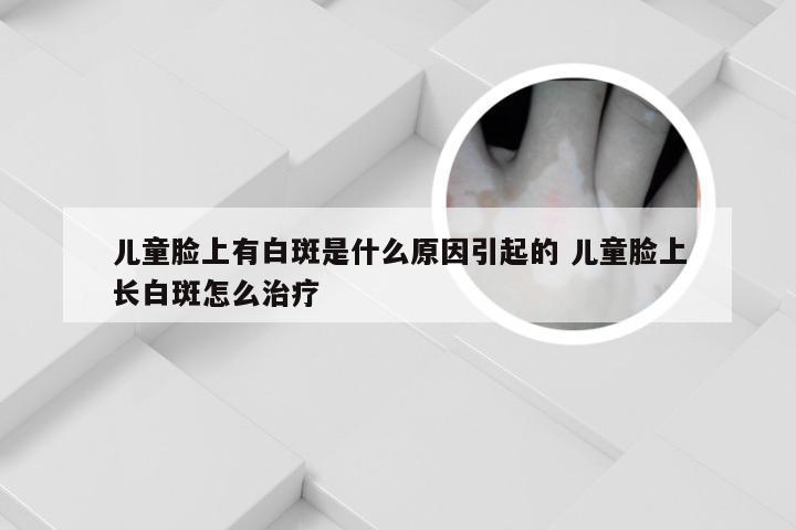 儿童脸上有白斑是什么原因引起的 儿童脸上长白斑怎么治疗