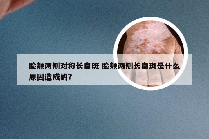 脸颊两侧对称长白斑 脸颊两侧长白斑是什么原因造成的?