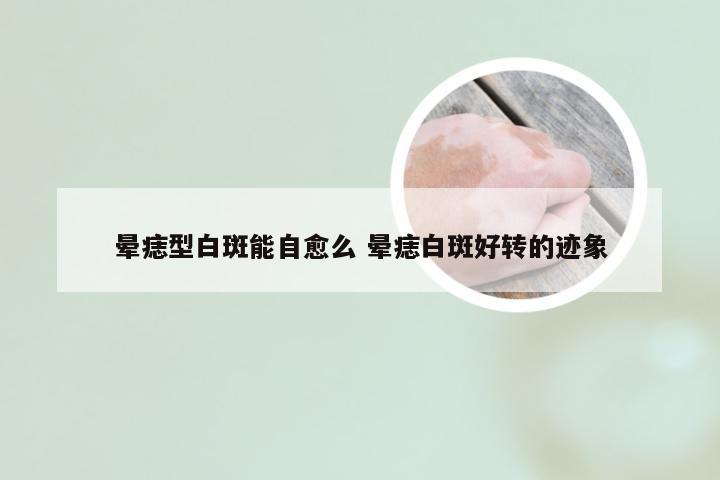 晕痣型白斑能自愈么 晕痣白斑好转的迹象