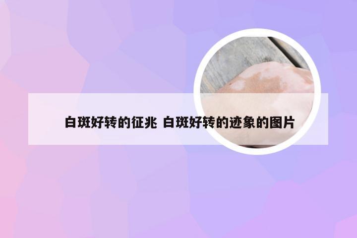 白斑好转的征兆 白斑好转的迹象的图片