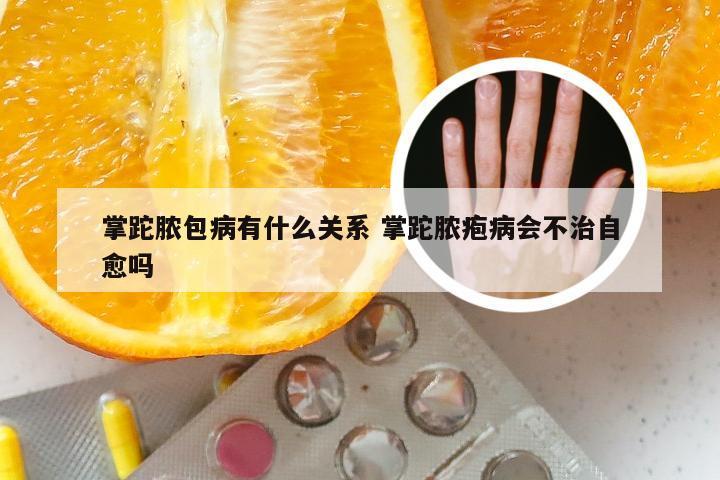 掌跎脓包病有什么关系 掌跎脓疱病会不治自愈吗