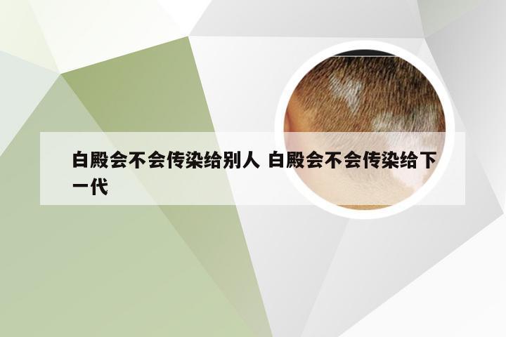 白殿会不会传染给别人 白殿会不会传染给下一代