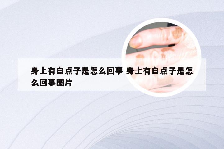 身上有白点子是怎么回事 身上有白点子是怎么回事图片