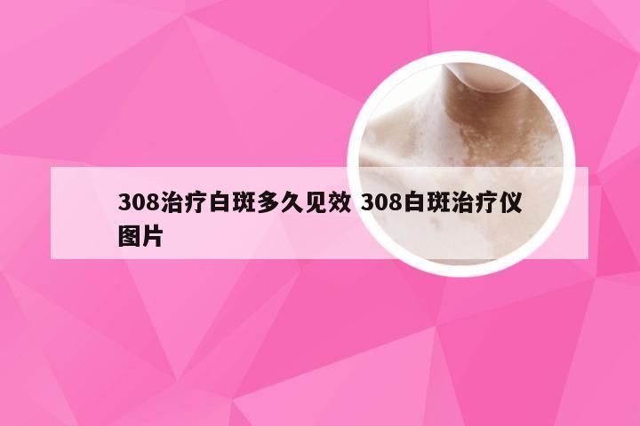 308治疗白斑多久见效 308白斑治疗仪图片