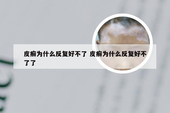 皮癣为什么反复好不了 皮癣为什么反复好不了了