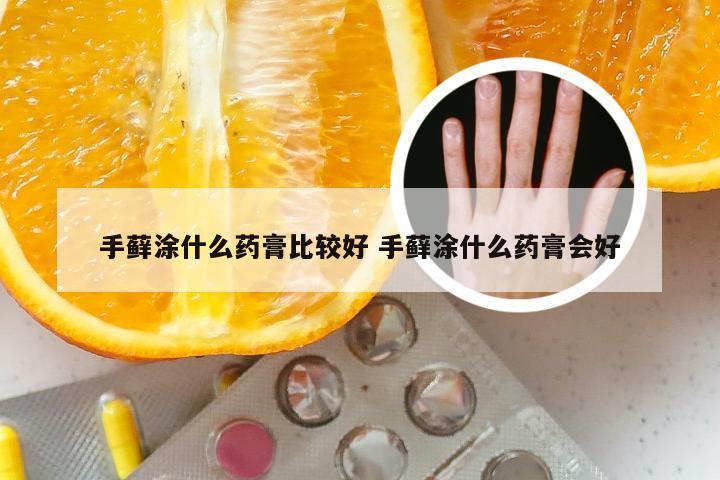 手藓涂什么药膏比较好 手藓涂什么药膏会好