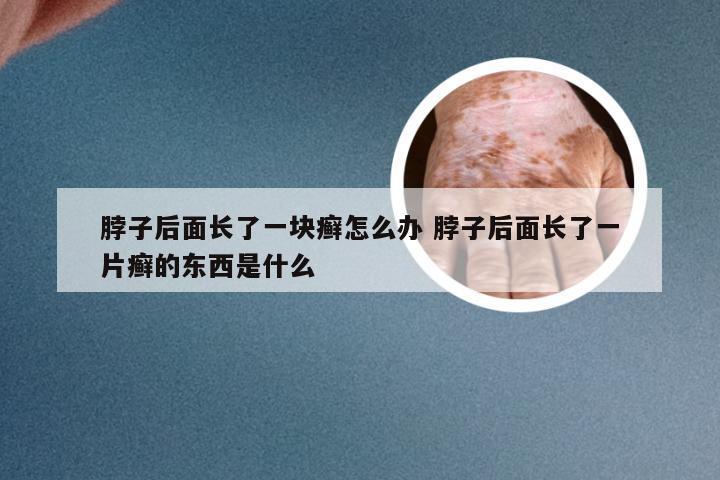 脖子后面长了一块癣怎么办 脖子后面长了一片癣的东西是什么