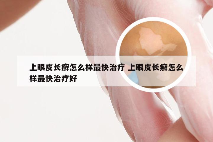 上眼皮长癣怎么样最快治疗 上眼皮长癣怎么样最快治疗好