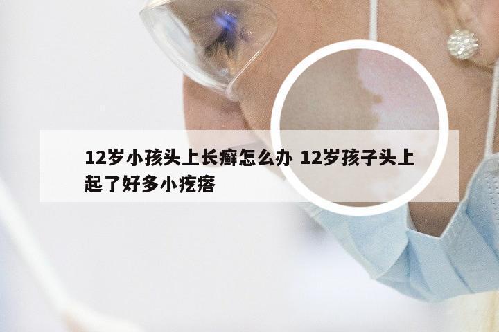 12岁小孩头上长癣怎么办 12岁孩子头上起了好多小疙瘩