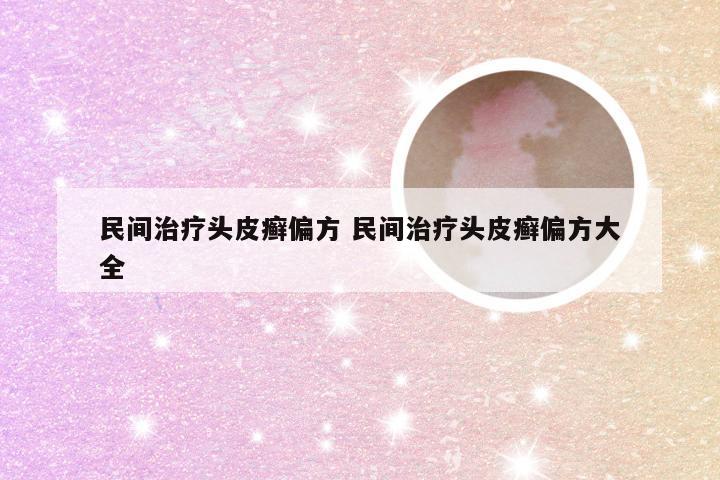 民间治疗头皮癣偏方 民间治疗头皮癣偏方大全