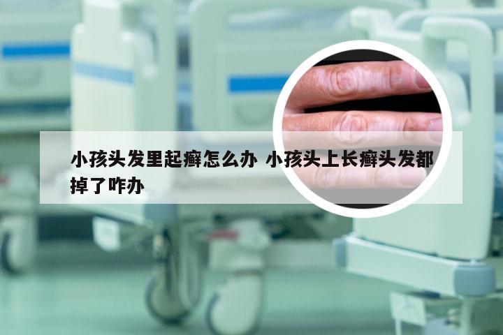 小孩头发里起癣怎么办 小孩头上长癣头发都掉了咋办