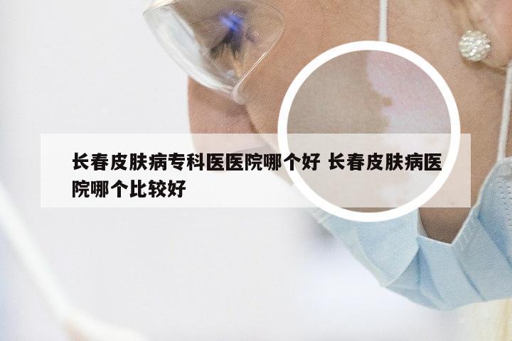 长春皮肤病专科医医院哪个好 长春皮肤病医院哪个比较好