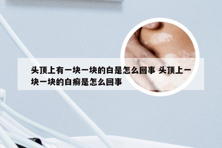 头顶上有一块一块的白是怎么回事 头顶上一块一块的白癣是怎么回事