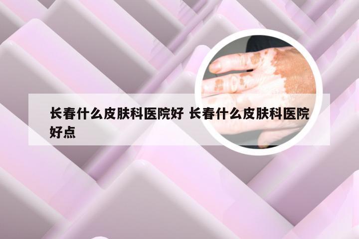 长春什么皮肤科医院好 长春什么皮肤科医院好点