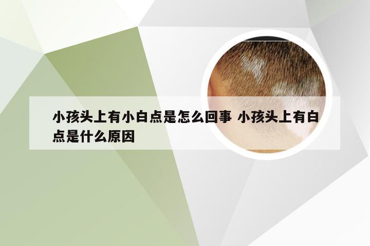 小孩头上有小白点是怎么回事 小孩头上有白点是什么原因