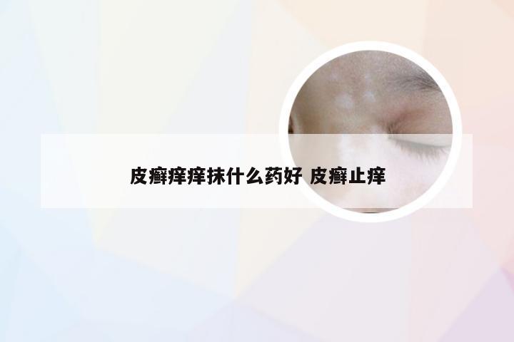 皮癣痒痒抹什么药好 皮癣止痒