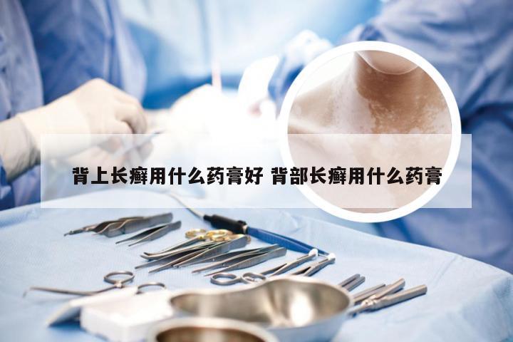 背上长癣用什么药膏好 背部长癣用什么药膏