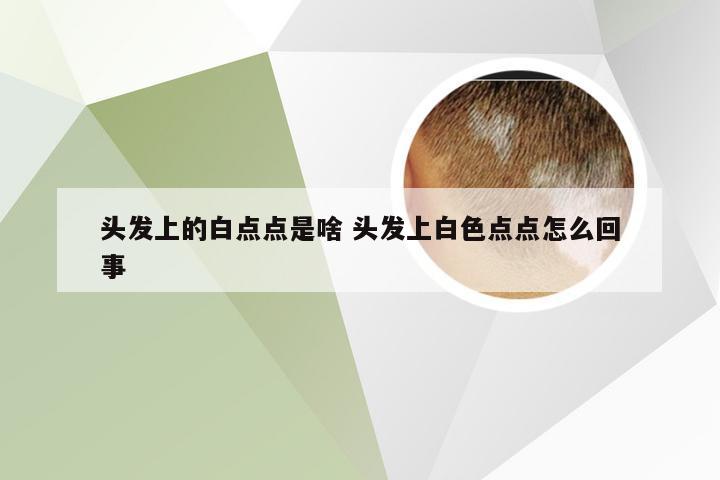 头发上的白点点是啥 头发上白色点点怎么回事