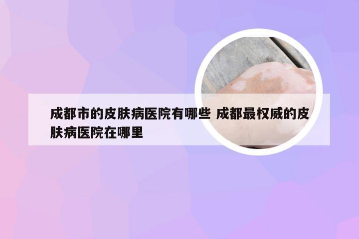 成都市的皮肤病医院有哪些 成都最权威的皮肤病医院在哪里