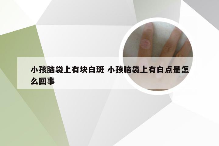 小孩脑袋上有块白斑 小孩脑袋上有白点是怎么回事