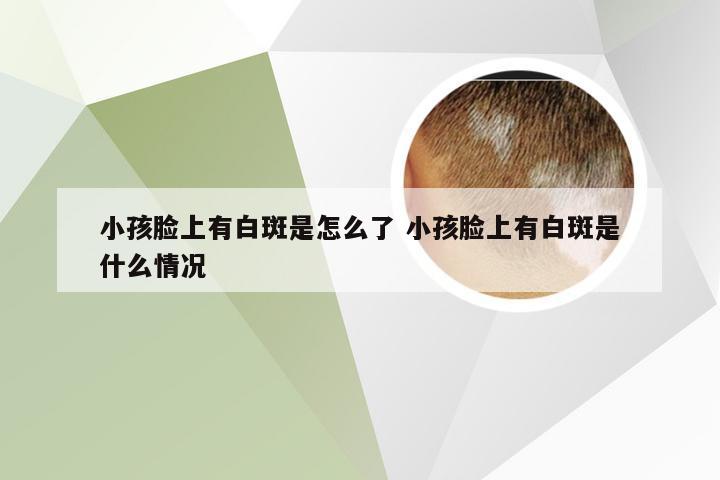 小孩脸上有白斑是怎么了 小孩脸上有白斑是什么情况