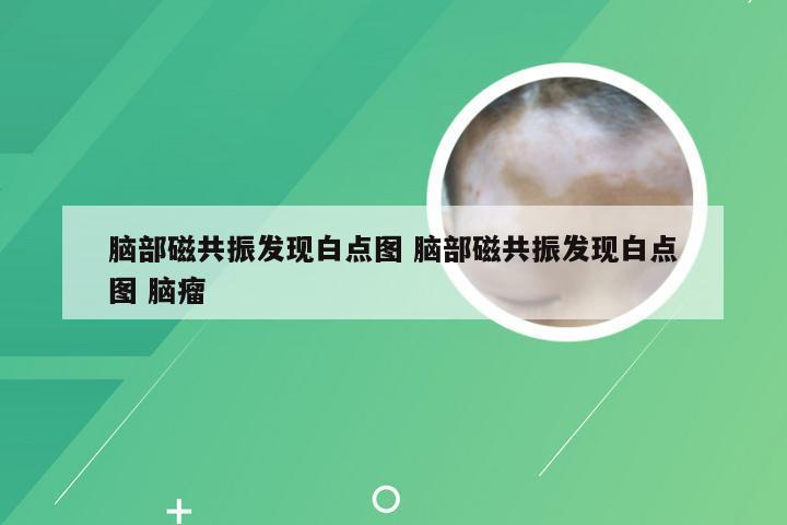 脑部磁共振发现白点图 脑部磁共振发现白点图 脑瘤