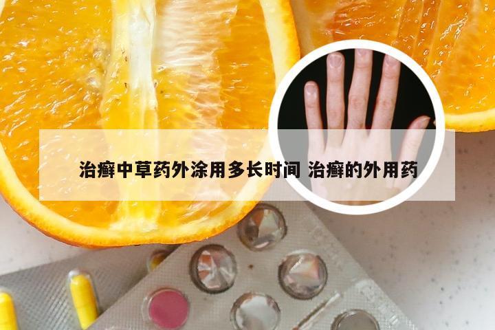 治癣中草药外涂用多长时间 治癣的外用药