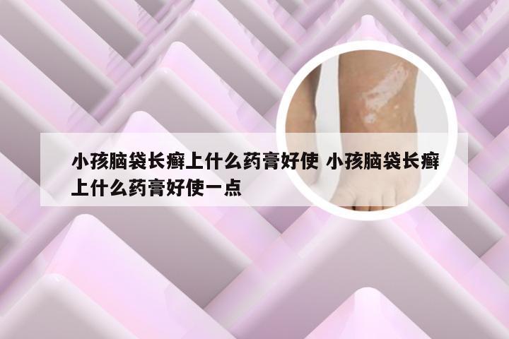 小孩脑袋长癣上什么药膏好使 小孩脑袋长癣上什么药膏好使一点