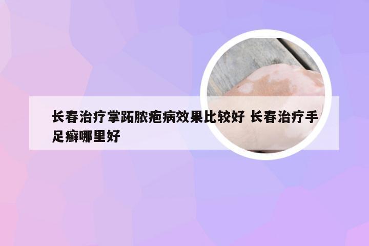 长春治疗掌跖脓疱病效果比较好 长春治疗手足癣哪里好