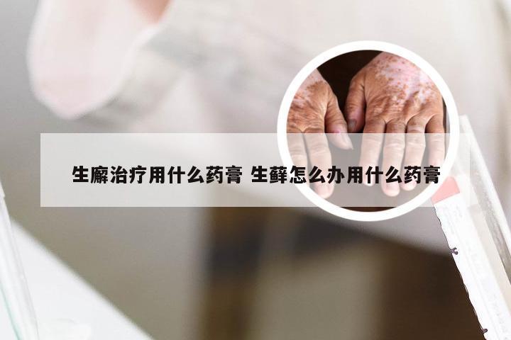 生廨治疗用什么药膏 生藓怎么办用什么药膏