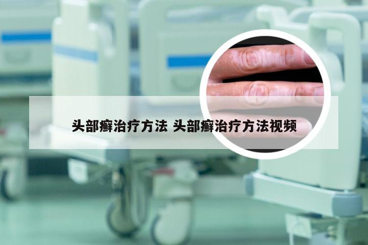 头部癣治疗方法 头部癣治疗方法视频