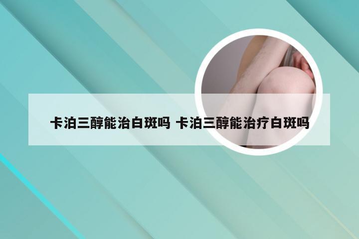 卡泊三醇能治白斑吗 卡泊三醇能治疗白斑吗