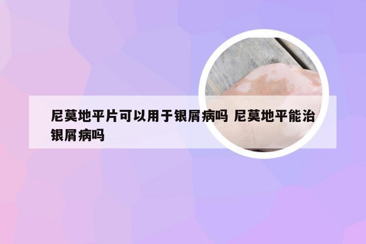 尼莫地平片可以用于银屑病吗 尼莫地平能治银屑病吗